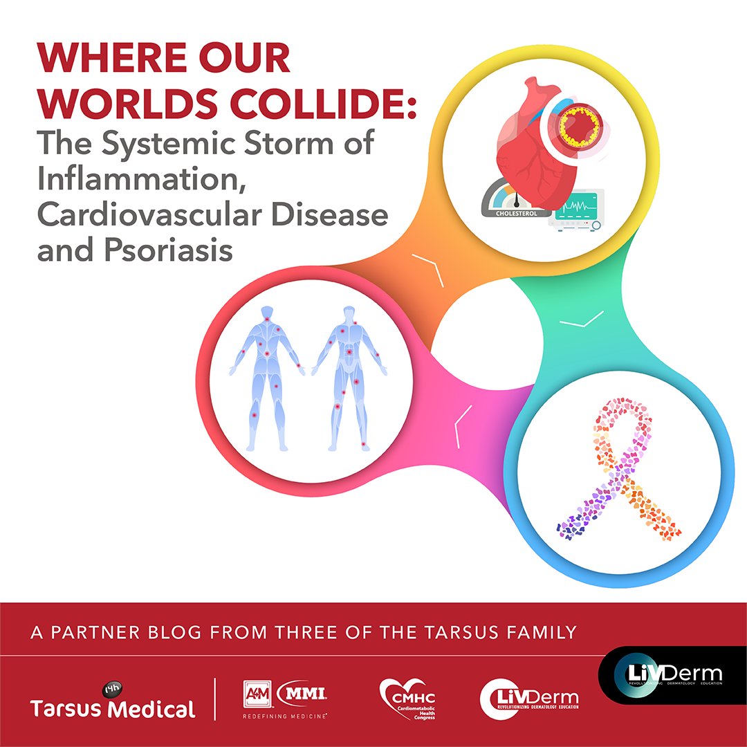 LiVDerm's tweet image. Studies have demonstrated a link between cardiovascular complications and psoriasis, hypothesizing that genetic, environmental and social risk factors may play a role in the high prevalence of comorbidities

Read more: go.livderm.org/3nPdwb1
#PartnerBlog #DermAppeal #Psoriasis