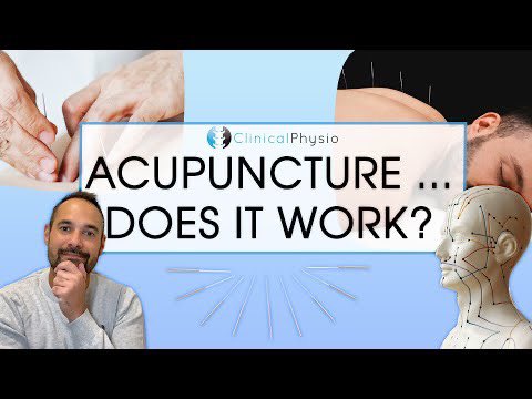 Did anyone ask for an Evidence Based BALANCED view of #Acupuncture in Physio?! HERE YOU GO! ➡️ youtu.be/3tSjOqAFZFs ⭐️
