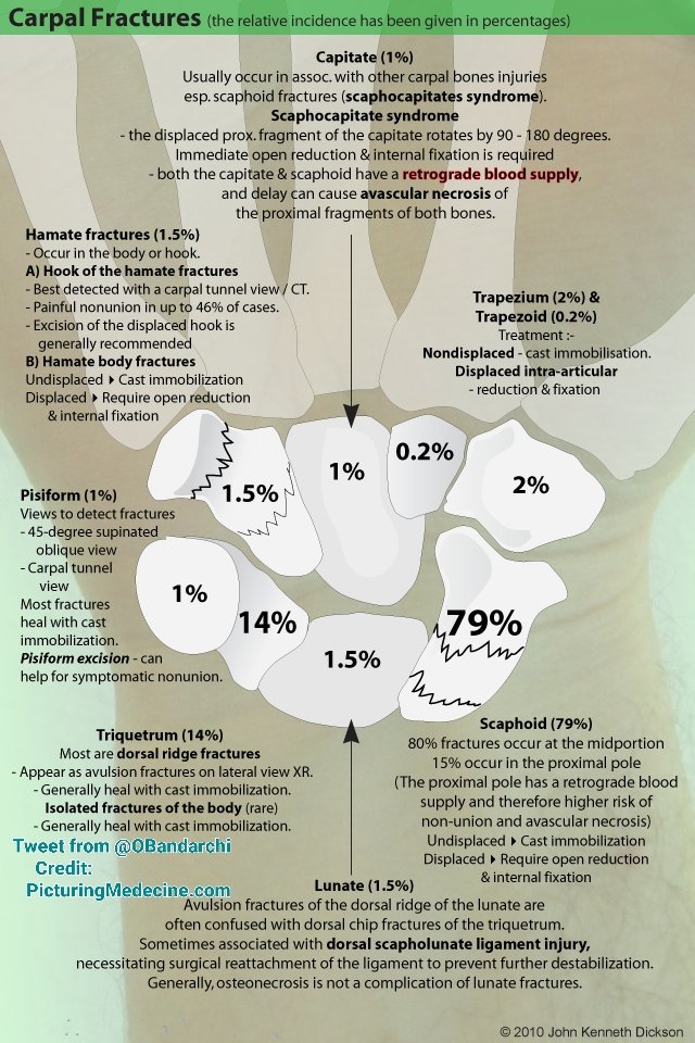 I love this infographic ♥️ In one page mentioned the relative incidence of fracture in each carpal bone and explained briefly for each entity. It's really useful 👌
