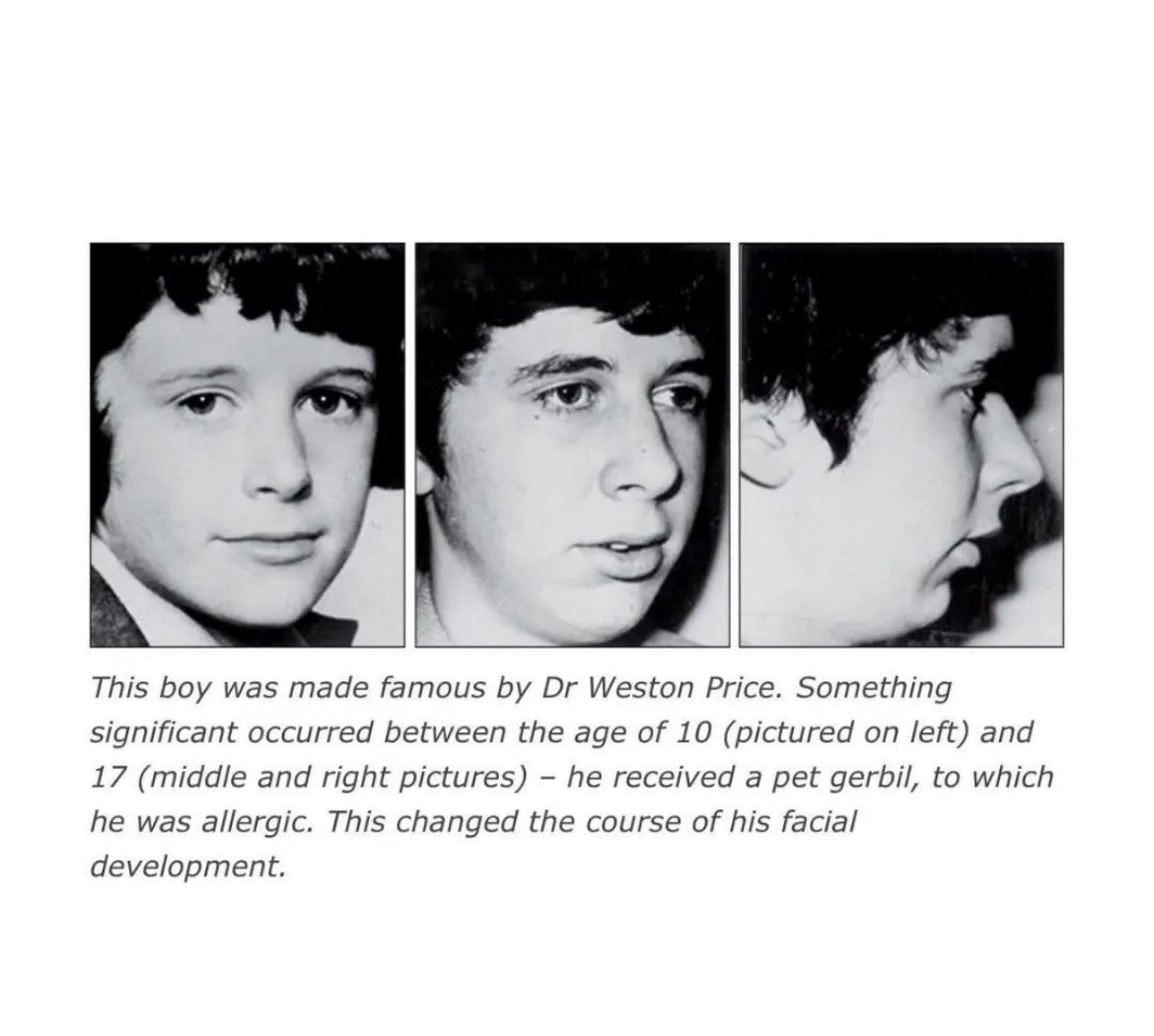 Famous Mouth Breather