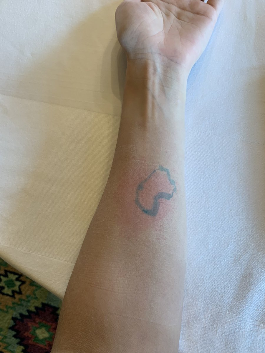 The many faces of QST testing with @KhannaLabNYU (does this count as facial grimace? 😂) 

Aside from Raj’s beautiful artwork, I’m still surprised that my sensitivity didn’t map directly onto the inflamed area! 

#NAPainSchool  📷: <a href="/grahlarvina/">Arvina Grahl</a>