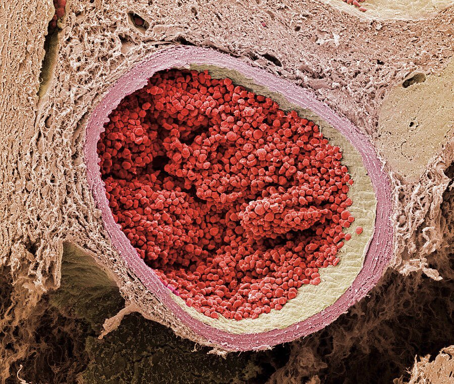 Electron microscope image of a section through an aorta filled with red blood cells.

By <a href="/microscopicture/">microscopic images.</a> 

#neuroscience #NeuroTwitter #Science #sciencetwitter #Bioinformatics #biochemistry #biology #MedTwitter