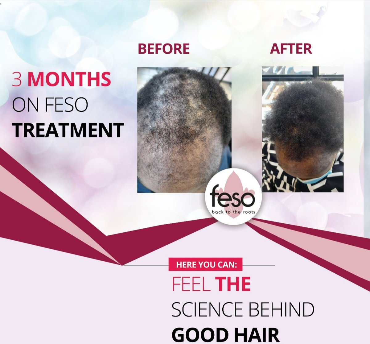 #BreakingNews 
Restore your CONFIDENCE

REPAIR, RESTORE YOUR RECEDING HAIRLINE avoid HAIRLOSS 

Feso Hair products available in following Pharmacies 👇

RETWEET 🙏
<a href="/candacy_rutendo/">Candacy Rutendo Gurupira</a> <a href="/ANGEZHA_Vauya/">Angezha - Mamoyo Murozvi</a> @ma_vumani <a href="/Mavhure/">Rufaz--Jerera❤King❤</a> <a href="/Flamisharon/">nursebae</a> @makawandie <a href="/MatopeNigell/">Hon. MatopeNigel</a> <a href="/penzura_wacho/"> Pᴇɴᴢᴜʀᴀ_Wᴀᴄʜᴏ </a> <a href="/runya_gee/">Babes_WekwaZvimba🇿🇼❤️</a>