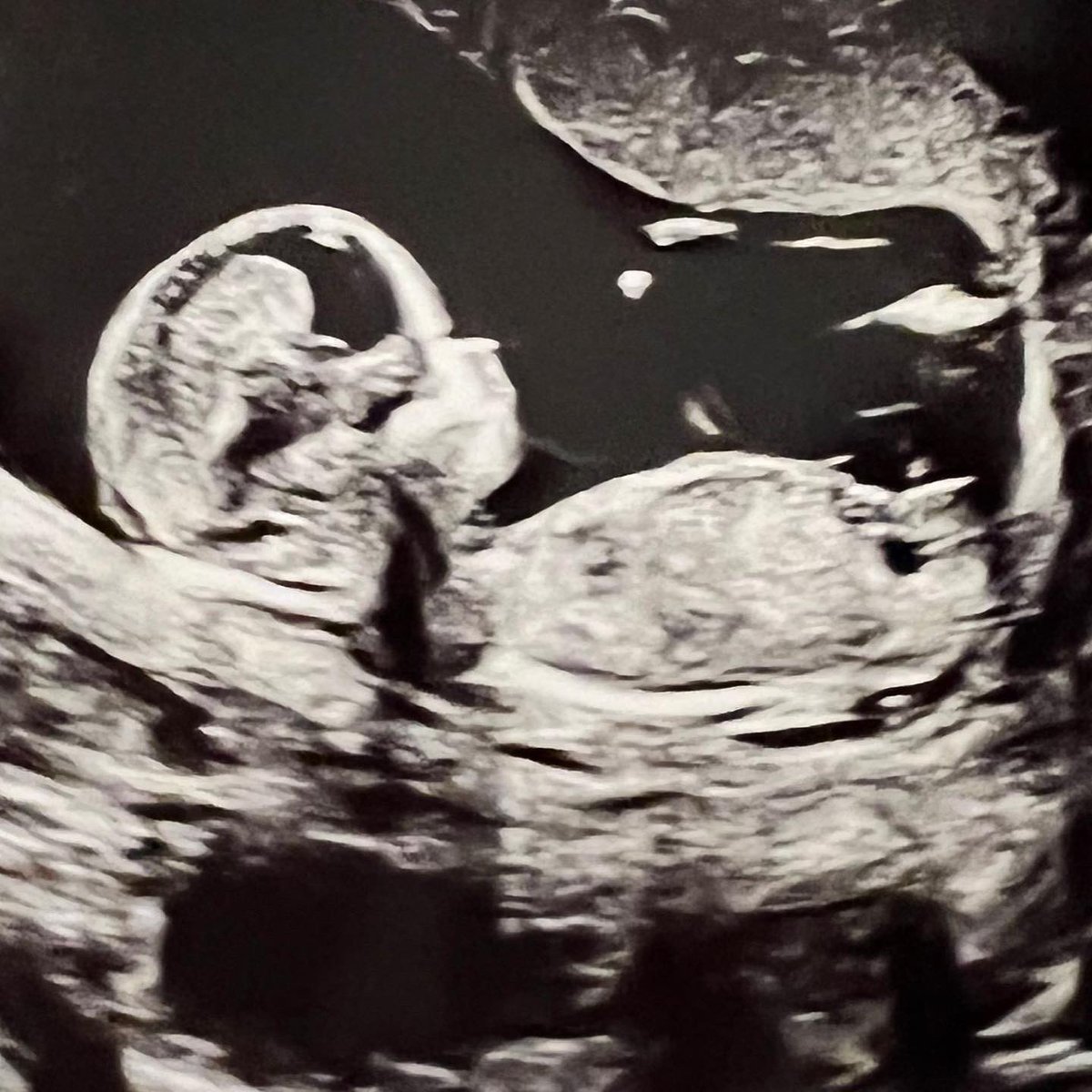 claresiobhan's tweet photo. We’re super excited to announce we’re pregnant! 🥰❤️ 

Our newest lil family member will be joining us in October this year, and we couldn’t be happier  👶🏼🍼 https://t.co/JzuywaBsWu