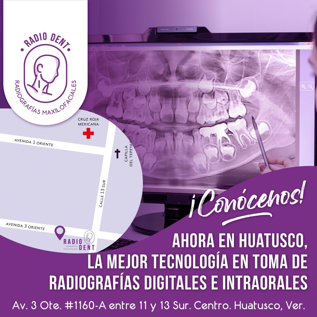 AgoraHuatusco's tweet photo. #RadioDent

La mejor tecnología en toma de Radiografías Digitales e Intraorales Maxilofaciales. 

📌Avenida 3 Oriente #1160 entre calles 11 y 13.  A la vuelta de la cruz roja

📱📲Whatsapp: 273 107 45 07 https://t.co/gbdIoFJIcf