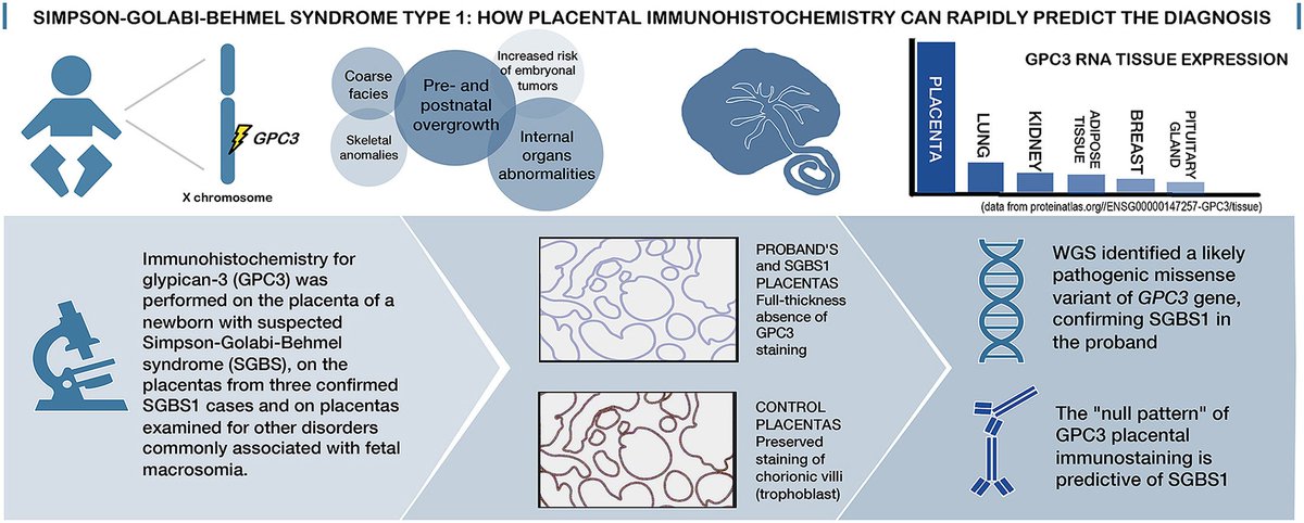 annameroni91's tweet photo. Check this out! When suspecting #simpsongolabibehmel syndrome, your pathologist can falicitate a super-quick immunohistochemistry prediction on placenta 🤩 
From an idea of the smart twitterless Giacomo Fiandrino and the equally smart @FabioSirchia 
https://t.co/eP8sKNzk4G https://t.co/HjawD68KcD