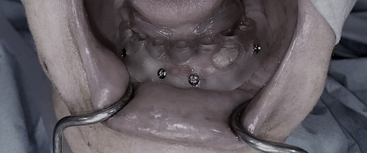 FabLab 3D Hospital Marañón tweet media