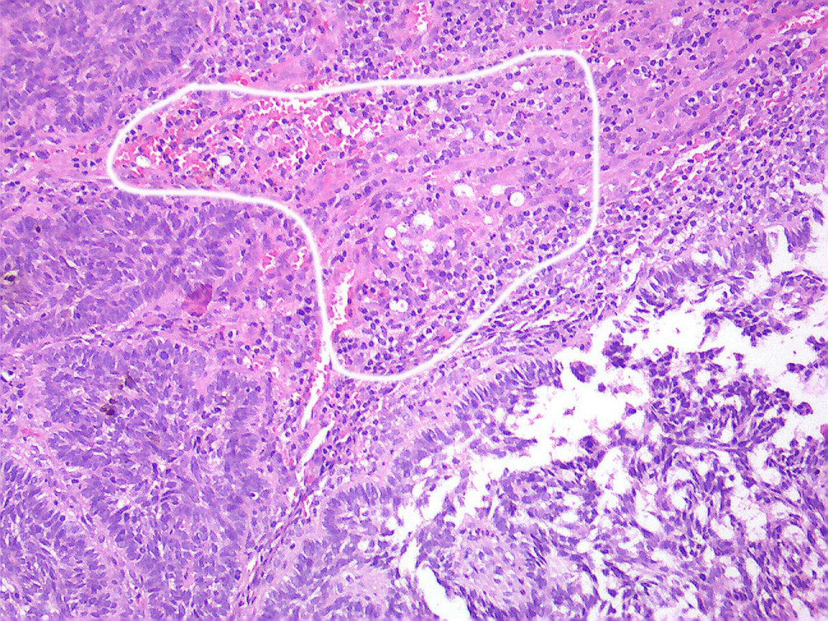 Gerônimo Jr. tweet media