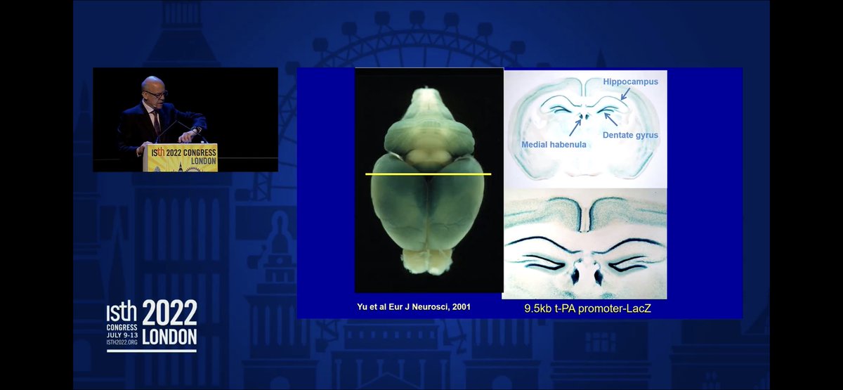 johnmatt's tweet photo. tPA is expressed all over the mouse brain. Fascinating plenary talk by Dr. Robert Medcalf at  #ISTH2022 https://t.co/duaQoOpe6Y