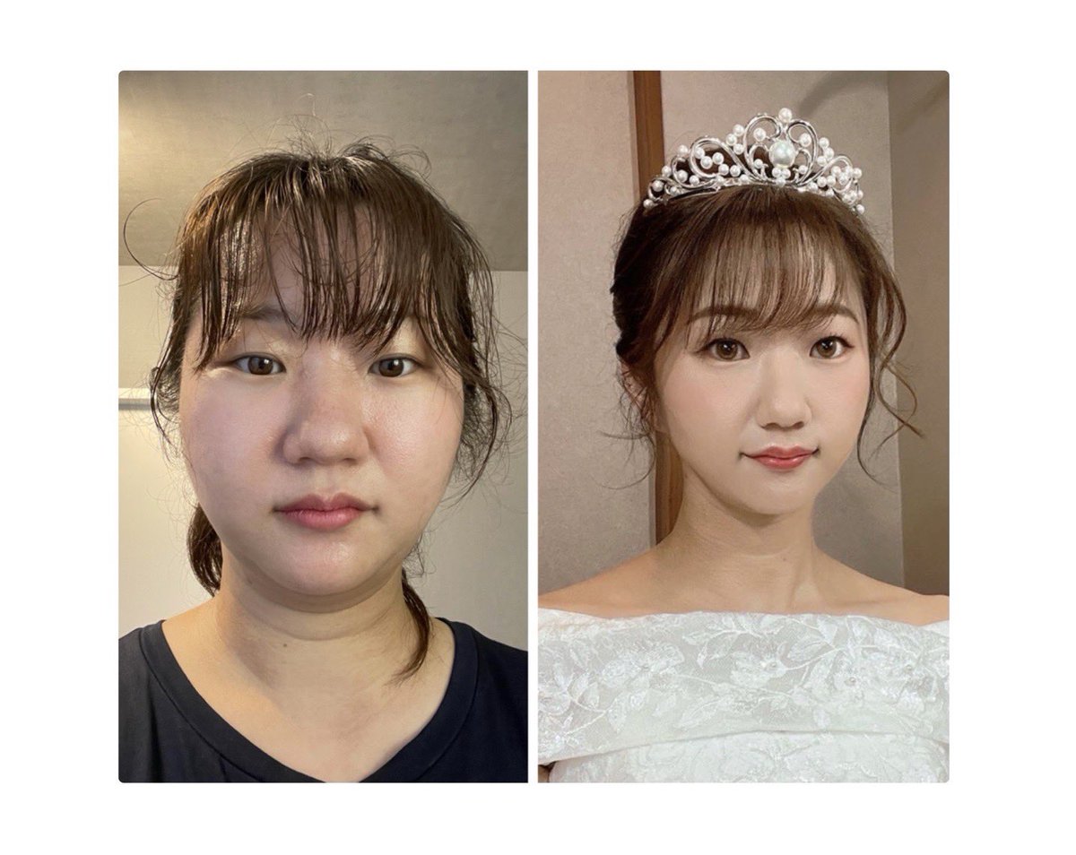 kisakitea7's tweet photo. ついに約15キロのダイエットに成功して結婚式も無事終わりました～✨

顔のサイズ、、、うわあ、、今こうしてみると、ダイエットしてなかったらって考えたらぞっとします（笑）
結婚式の時に旦那にも「頑張ったね、綺麗」っていってもらえました！頑張ってよかった～🥺♡ https://t.co/4qcbtk9AgQ
