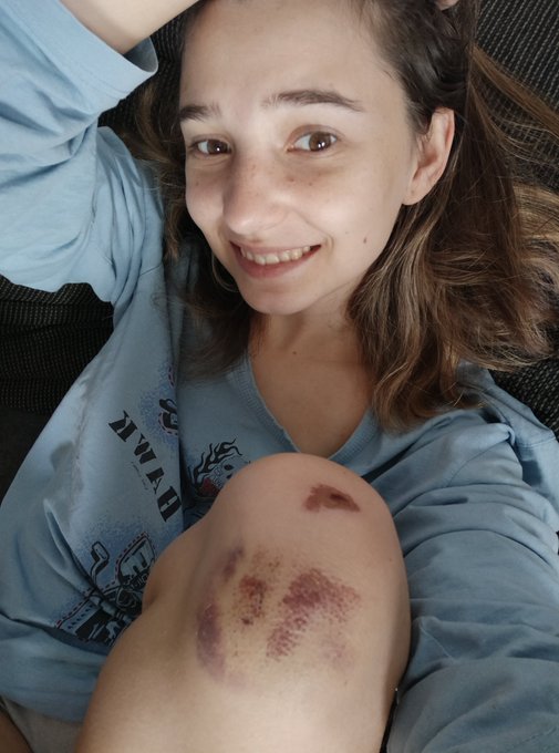 🙈🙊 https://t.co/T5ChloItpL<a href="/tag/smile"class="tags"><span>#smile</span></a><a href="/tag/nomakeup"class="tags"><span>#nomakeup</span></a><a href="/tag/modeling"class="tags"><span>#modeling</span></a><a href="/tag/sexi"class="tags"><span>#sexi</span></a><a href="/tag/onlyfans"class="tags"><span>#onlyfans</span></a>