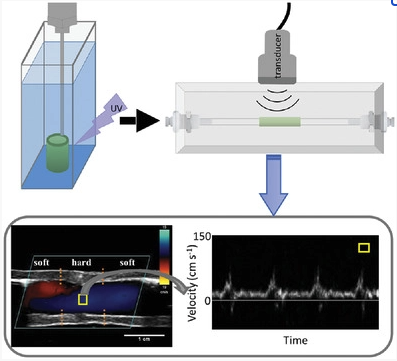Check out our recent publication on Advanced Functional Materials. Cool one-step printing of arterial phantoms (no more freeze-thaw) compatible with ultrasound imaging.  doi.org/10.1002/adfm.2…
