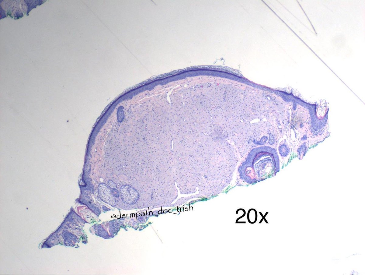 Dermpath_doc_trish tweet media