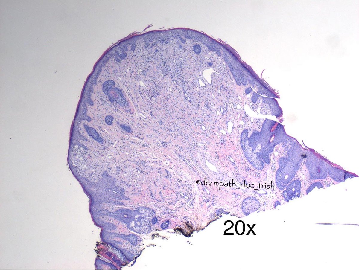 Dermpath_doc_trish tweet media