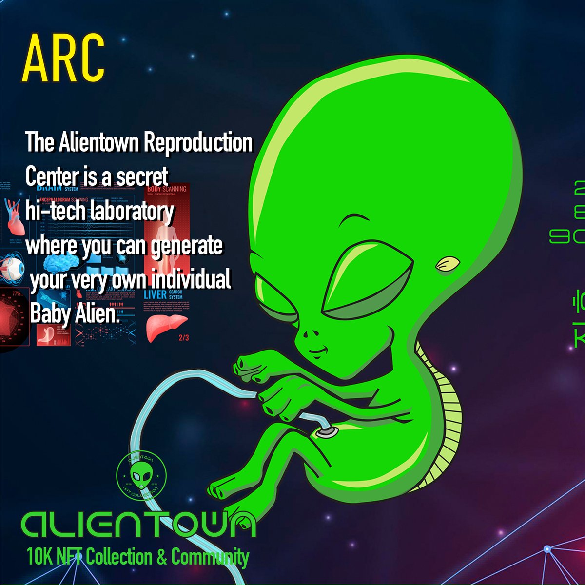 AlienTownnft's tweet photo. Every citizen of @AlienTownnft  will be able to claim a baby Alien, this will be our second drop, available only to our Fellow Aliens. So get your's now directly on @opensea  at https://t.co/a9x9aJgAQ2
#NFTs  #NFT https://t.co/FUWKQ2C3u6