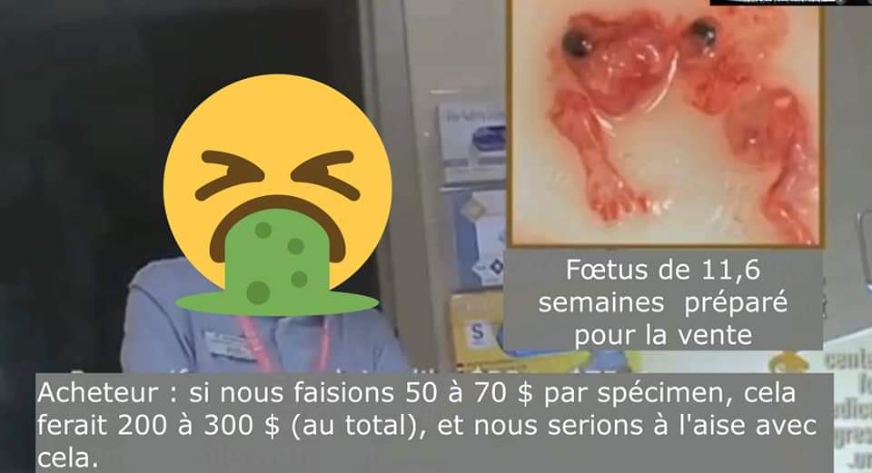 JeanCherriere's tweet image. #PlannedParentHood  #StemExpress #centerformedicalprogres