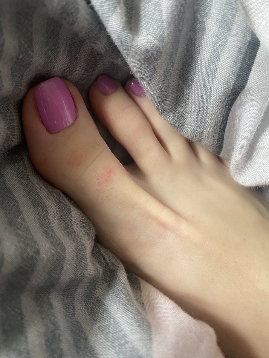 bolandcat5's tweet photo. These toes are screaming for tickles, can I have a volunteer? ๐๐ฃ๐ชถ
#SellingFeetPics #SellingContent #Toes #Ticklish #FootFetish #NewContentCreator #FirstTimeSeller #TickleMyFeet https://t.co/cR3hnhwWZs