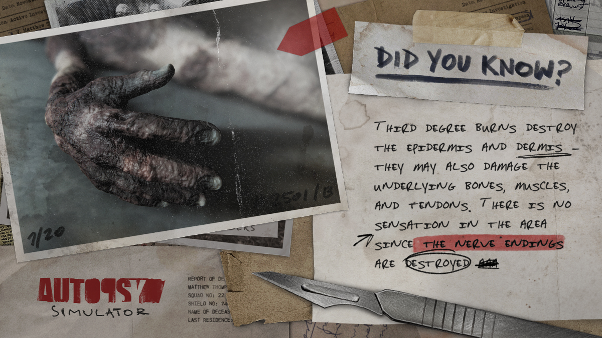 Autopsy Simulator on Twitter "Did you know? 🤔 Burns are categorized