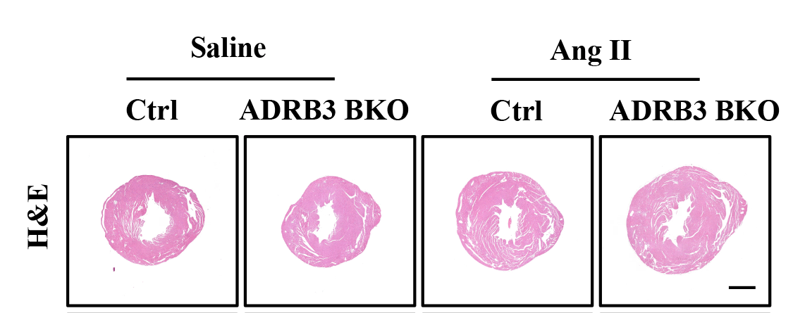CircRes's tweet photo. Lin &amp; colleagues demonstrate that #ADRB3 activation in brown #adipocytes protect against #AngII induced cardiac remodeling via suppressing #iNOS containing #exosomes. Learn more at https://t.co/GmLdrM6mts https://t.co/RsfXTXivUW