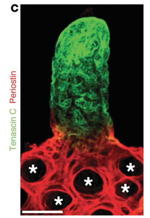 PetrovaLab's tweet photo. 📢 Explore small #intestinal #fibroblast subsets @SingleCellBroad
👇
https://t.co/iDocXZ3bXJ
Example shows BMP, VEGFA and ECM #zonation along crypt-villus axis
Link to the full paper: https://t.co/atgBkgJSTL https://t.co/OKK1LTpKhL