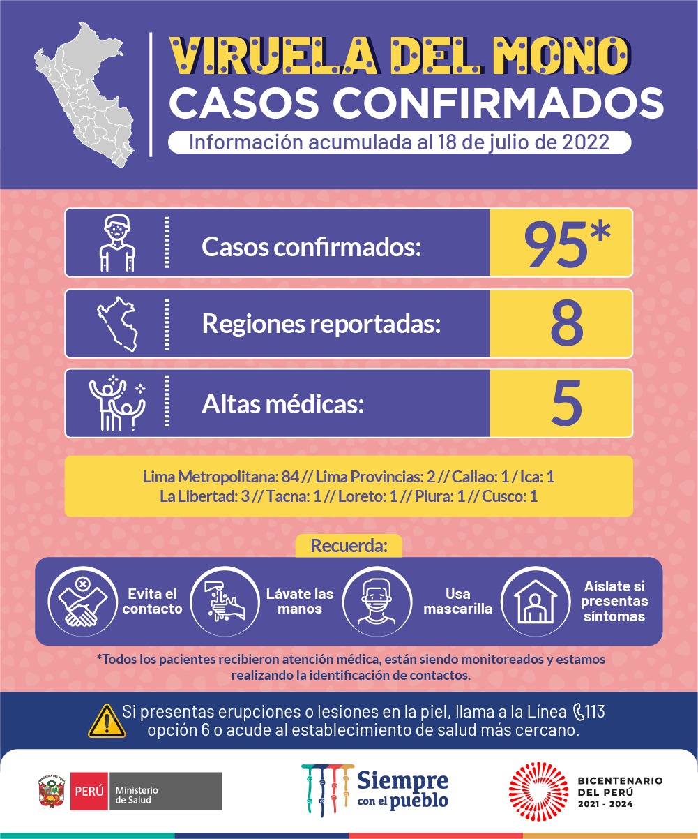 viruela del mono 18-7-22