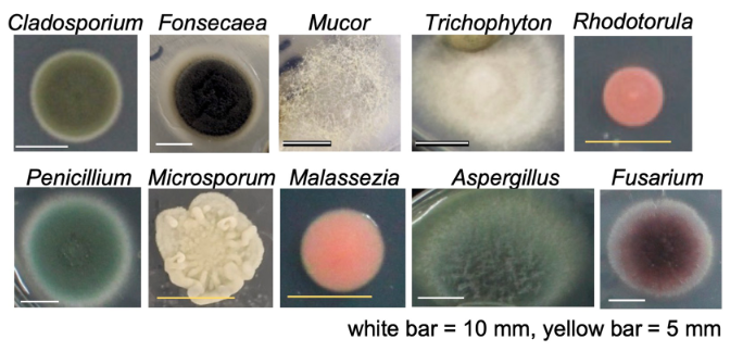 MakingC19Waves's tweet photo. A new study finds various bacterial and fungal colonies on 😷 including "several pathogenic microbes." The authors "propose that immunocompromised people should avoid repeated use of masks to prevent microbial infection." https://t.co/CQ9p0OV2oD https://t.co/Qbl4dafmTH