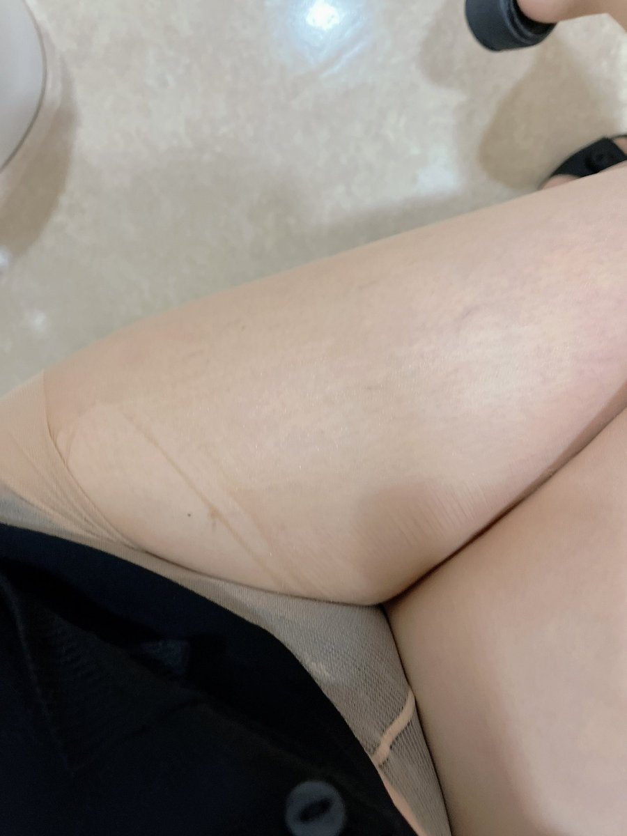 hanechan_mchan's tweet photo. 買ったばっかりのストッキング破れたんだが😢昨日伝線したばっかりなのに…。
けどこのまま犯されるのもありかな❤️ https://t.co/3rAlYqCQC8