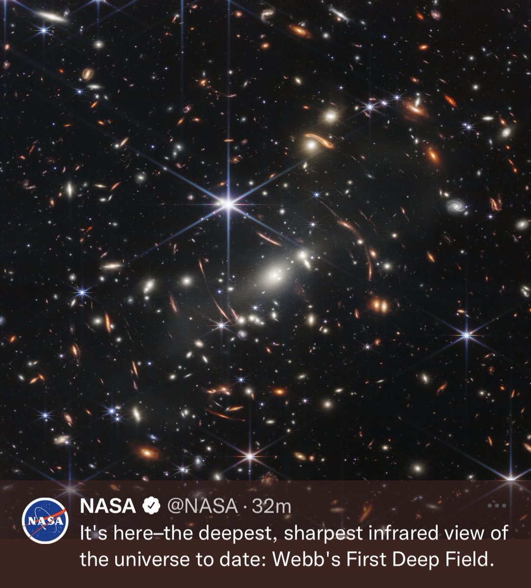 I can never remember if this one is gout or pseudo-gout