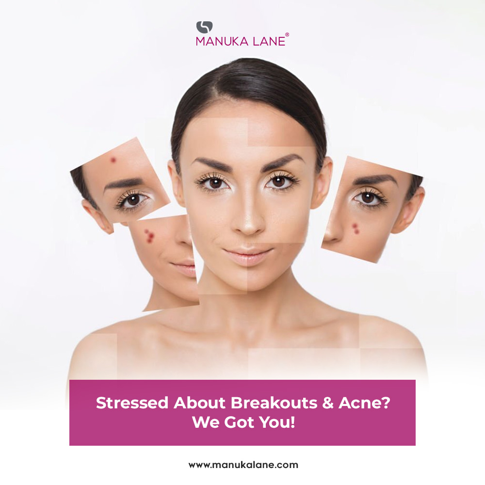 ManukaLane's tweet photo. Order our anti-acne products today and bid farewell to this unwelcome friend: https://t.co/WmlcZYEESU

#manukalane #saynotoacne https://t.co/9sGf8ZCPav
