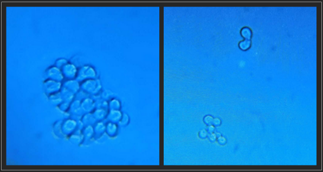 #ImageOfTheWeek We've finally got some cells going in the lab! Very thankful for collaborators to make this happe. <a href="/ucsc/">UC Santa Cruz</a> visiting researcher Sarah from <a href="/DrLauraSanchez/">Dr Laura Sanchez</a>'s lab is getting <a href="/PhysicsCWRU/">CWRU Physics</a> group member Vignesh up to speed for our collaboration on expansion microscopy🔬