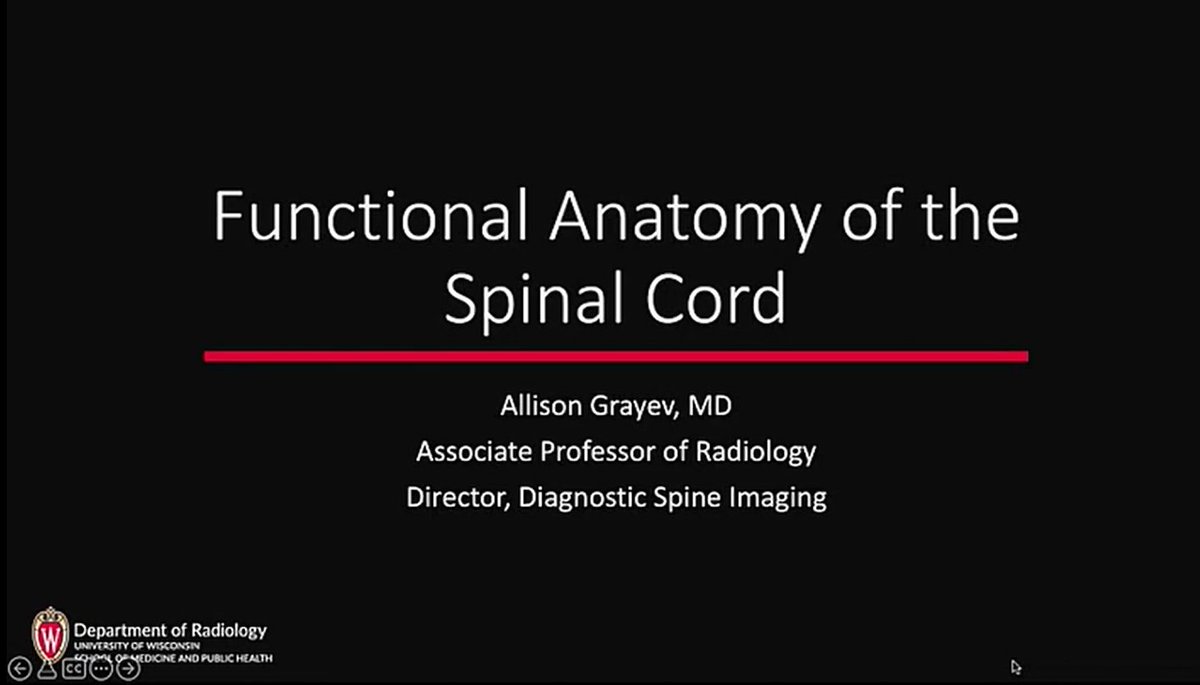 Check out "Functional Anatomy of the Spinal Cord," presented by Dr. Allison Grayev and the next video in #ASNR's Neurocurriculum Live Summer Series. Watch it here &amp; tune in for more videos throughout the summer: ow.ly/KRMH50JTkNT
#Neuroradiology #RadRes #MedEd #Spine