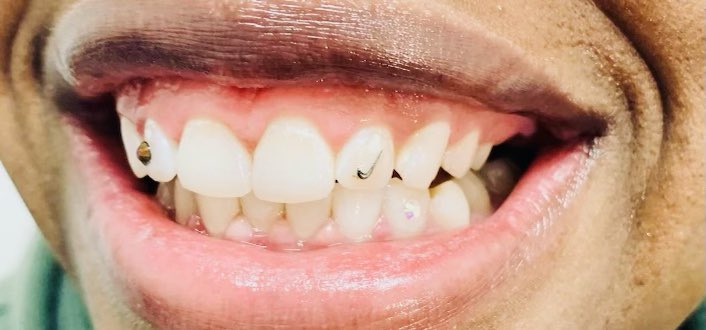 NJabirona's tweet photo. Calling all WSSU and NCAT students, I’ll be whitening teeth and applying tooth gems on students. In the fall, updates coming soon #wssu #ncat #teethwhiteing #prettyteeth #homecoming https://t.co/AI6iBCLuzo