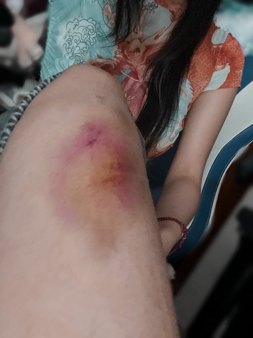 Creo que si fregué la rodilla x.x https://t.co/Sy0BrX11Bh