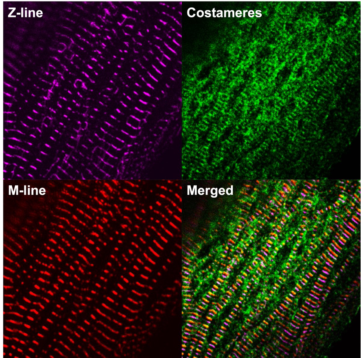 ZhenMa2046's tweet photo. Nice AiryScan @LovelessRadio image taken by @Bearbeerbelly of cardiomyocyte ultrastructure: costamere-sarcomere relationship. #Microscopy https://t.co/wFsiuoirhn
