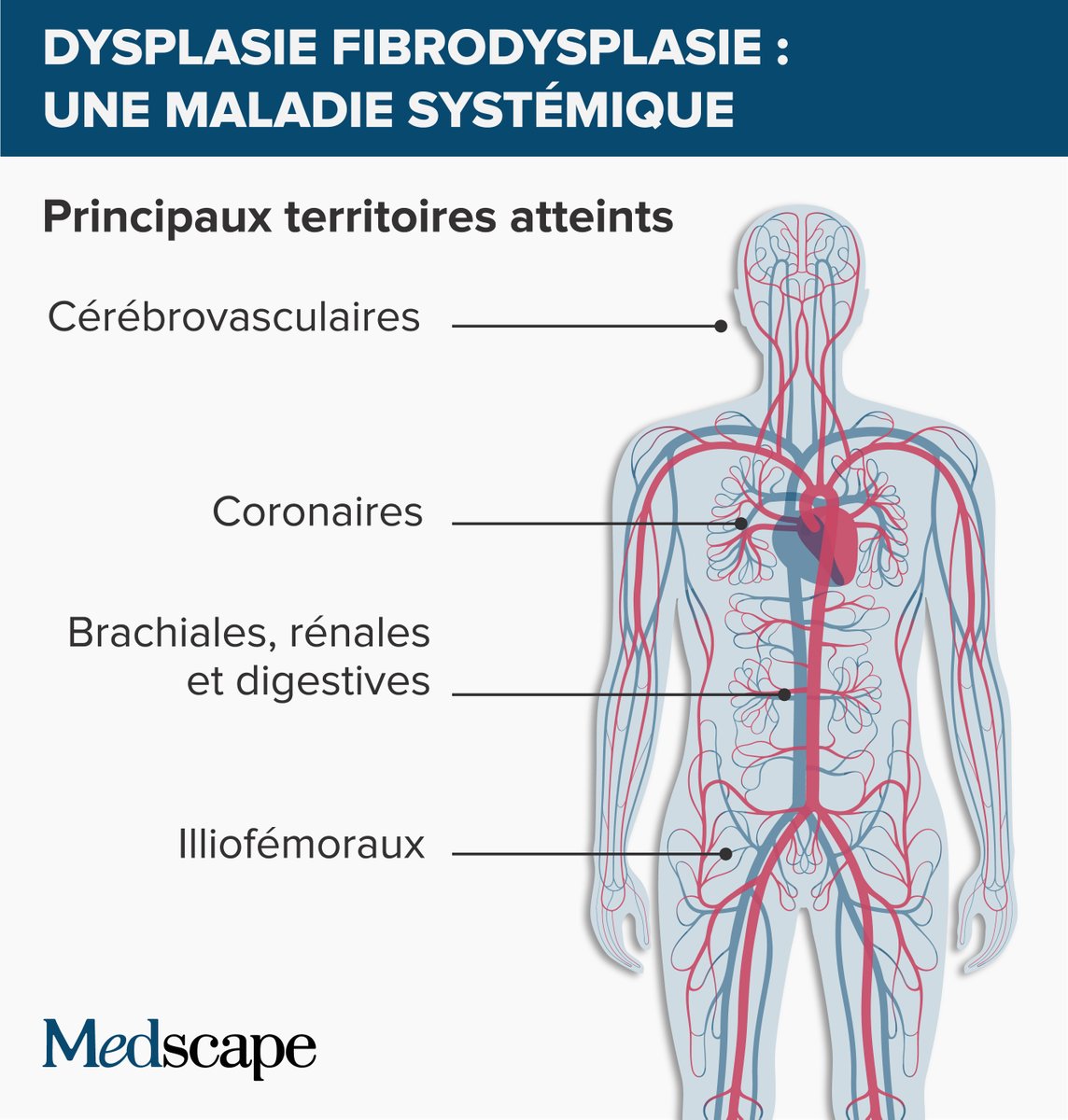 Medscape Cardiologie (@theheartorgfr) on Twitter photo Cas clinique : quel bilan d’extension pour cette fibrodysplasie ?
3e partie du cas présenté par <a href="/CJH_HTA/">cjhta</a>
<a href="/Rboulestreau/">Romain Boulestreau</a> <a href="/sfhta/">Société Française d'Hypertension Artérielle</a> <a href="/CHUBordeaux/">CHU de Bordeaux</a>
ms.spr.ly/6015bFQZl Cas clinique : quel bilan d’extension pour cette fibrodysplasie ?
3e partie du cas présenté par <a href="/CJH_HTA/">cjhta</a>
<a href="/Rboulestreau/">Romain Boulestreau</a> <a href="/sfhta/">Société Française d'Hypertension Artérielle</a> <a href="/CHUBordeaux/">CHU de Bordeaux</a>
ms.spr.ly/6015bFQZl