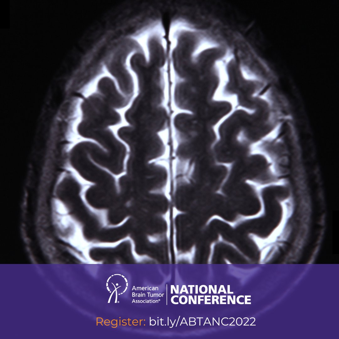 American Brain Tumor Association (@theabta) on Twitter photo Knowledge is power. 🧠 Learn from <a href="/UCSF/">UC San Francisco</a> and <a href="/MassGeneralNews/">MassGeneral News</a> experts about #braintumor imaging and tumor classification at our National Conference. Register: bit.ly/ABTANC2022
#btsm Knowledge is power. 🧠 Learn from <a href="/UCSF/">UC San Francisco</a> and <a href="/MassGeneralNews/">MassGeneral News</a> experts about #braintumor imaging and tumor classification at our National Conference. Register: bit.ly/ABTANC2022
#btsm