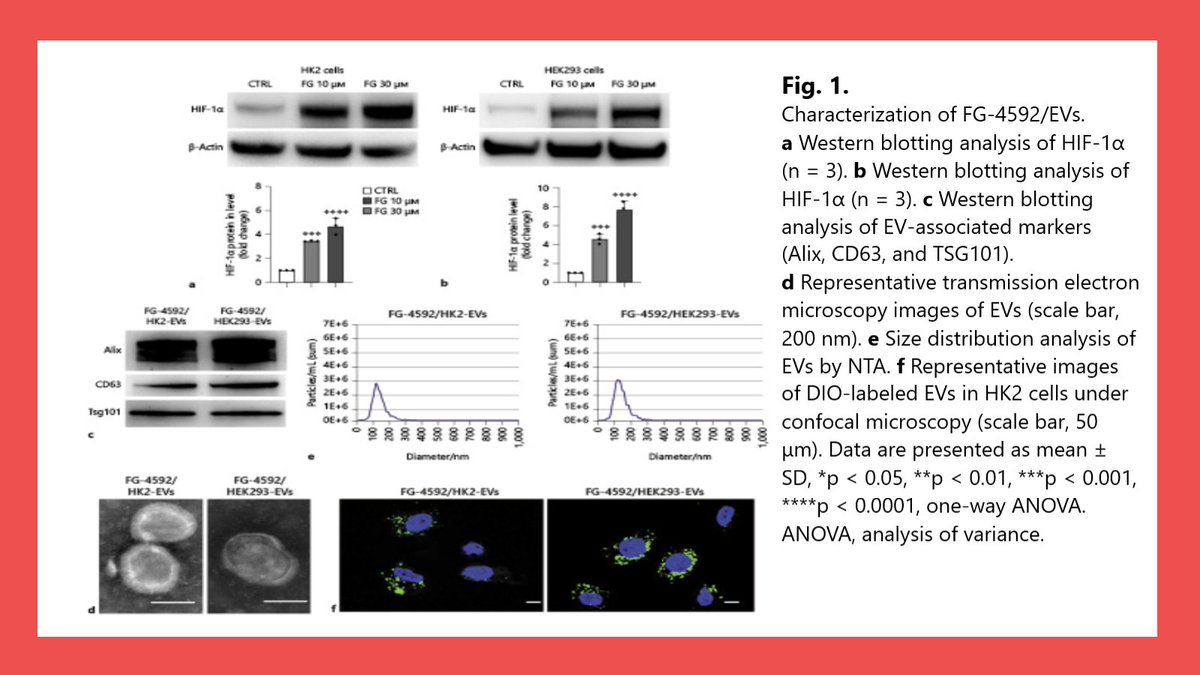 NephroKarger's tweet photo. Therapeutic Effect of Extracellular Vesicles Derived from HIF Prolyl Hydroxylase Domain Enzyme Inhibitor-Treated Cells on Renal Ischemia/Reperfusion Injury

✍ Zhao-Ying Ding 
📑 https://t.co/qxNXswZCQv

#KidneyDis #OpenAccess #AKI #CKD #HIF-PHI https://t.co/7fFXjUUr1e