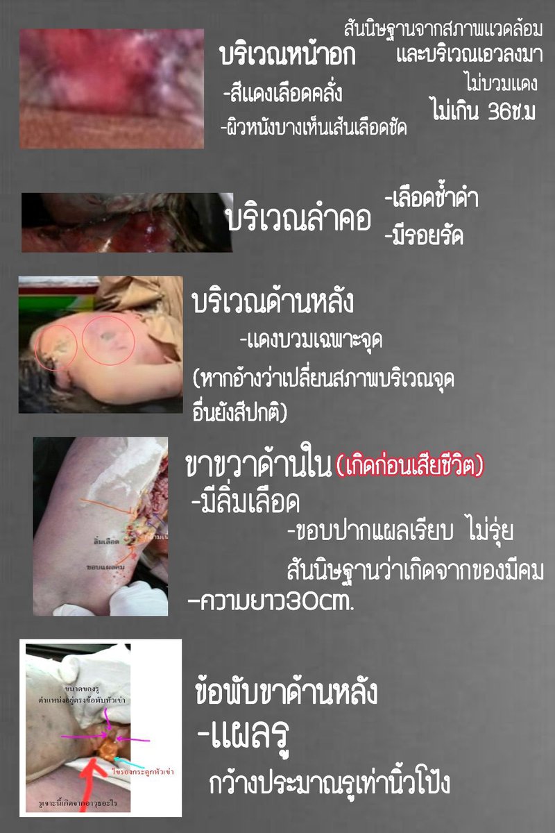 KhidDaen's tweet photo. !!สภาพศพคนทั้งโลกดูออก!!
!!ตกนํ้าตายหมอผ่าศพดูไม่ออก!!
!!ตกนํ้าตายหรือไปต่อสู้กับอะไรมา!!
!!ตกนํ้าตายกล้าเอาสภาพศพออกมาให้ประชาชนทั้งโลกเห็นหรือเปล่า
กล้าให้หมอทุกหน่วยงานกล้ายืนยันทุกแผลบนตัวศพว่าเกิดอะไรขึ้นกับศพ!!ศพไม่โกหกแต่คนโกหกศพ
#แตงโมต้องได้รับความยุติธรรม
#Saveอัจฉริยะ https://t.co/EcVRiwPV16
