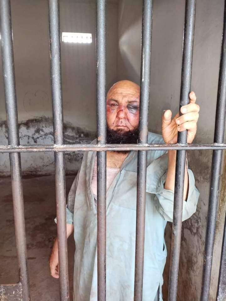 ایک نہیں پوری ھوٹل انتظامیہ گرفتار ہونی چائیے 
25 افغانی دہشتگردوں نے ایک سندھی کو بیدردی سے قتل کیا ہے تو سب کی گرفتاری چائیے 
#JusticeForBilalKaka