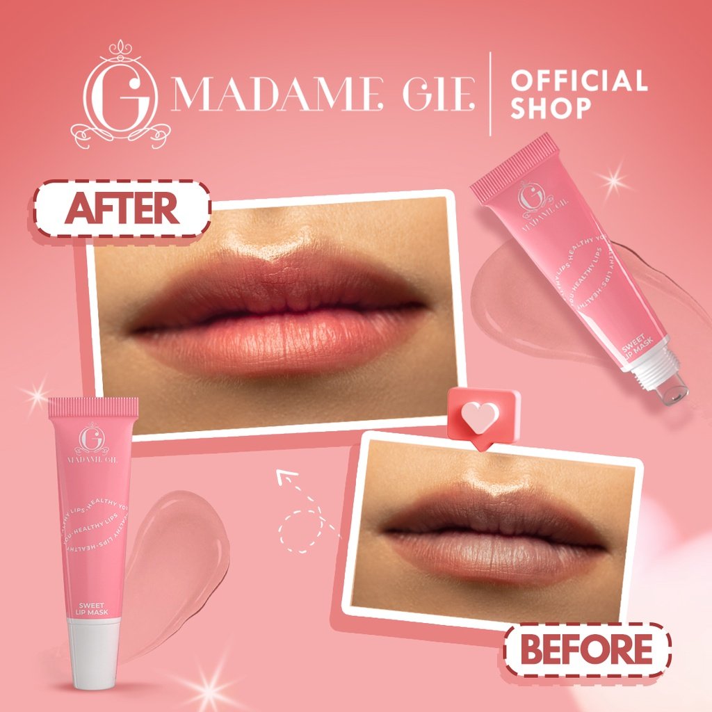 Dailymakeuppp's tweet photo. ✨ Rekomendasi lip mask link bio no 951 / skuy link nya : https://t.co/GwoPFmNqnJ

Cek katalog lainnya di https://t.co/gAxUhplXFs
#sweetlip #lipmask #perawatanbibir #lipbalm #moisturezer #lipbalmrekomended #rekomendasilipmask #racunskincare #racunshopee https://t.co/Ua0o3Hg66S