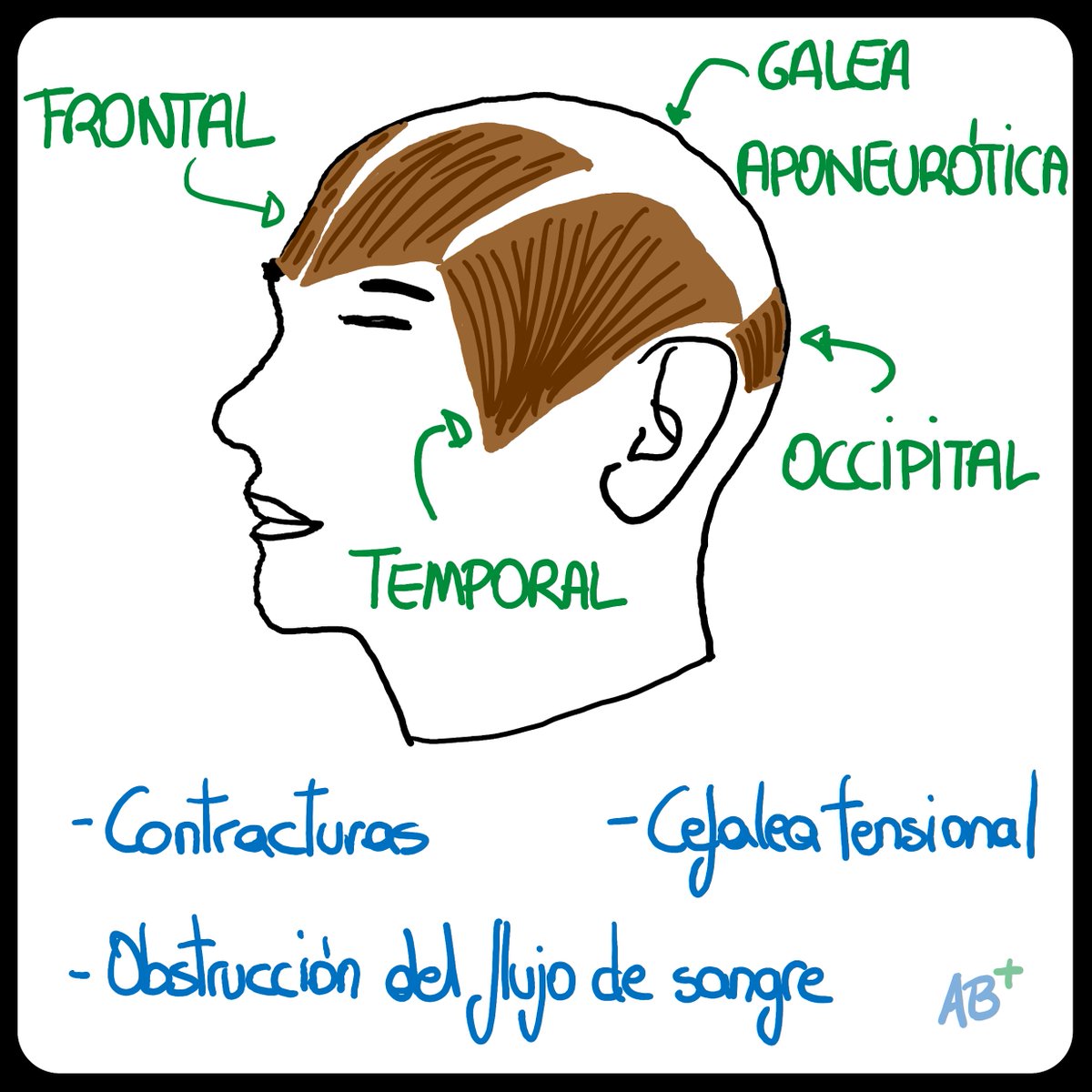 _ab_positivo's tweet photo. Las contracturas de los músculos de la cabeza son una posible causa de alopecia.
https://t.co/uxGjqlX8bA
https://t.co/1ukNizCfp9

https://t.co/lmXKlQ3ADv https://t.co/MuNGTGbwYD