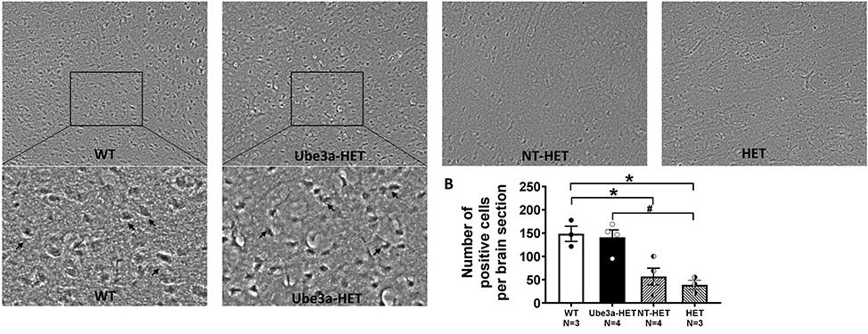 Hematopoietic stem cells (#HSCs) were treated with #GeneTherapy for functional rescue in #mice with #Angelman syndrome! <a href="/jmlasalle123/">Dr. Janine LaSalle</a> <a href="/UCDavisResearch/">UC Davis Research</a> <a href="/FinkLab/">Fink Lab</a> <a href="/hmg_journal/">Human Molecular Genetics</a> #mousephenotype
academic.oup.com/hmg/article/30…