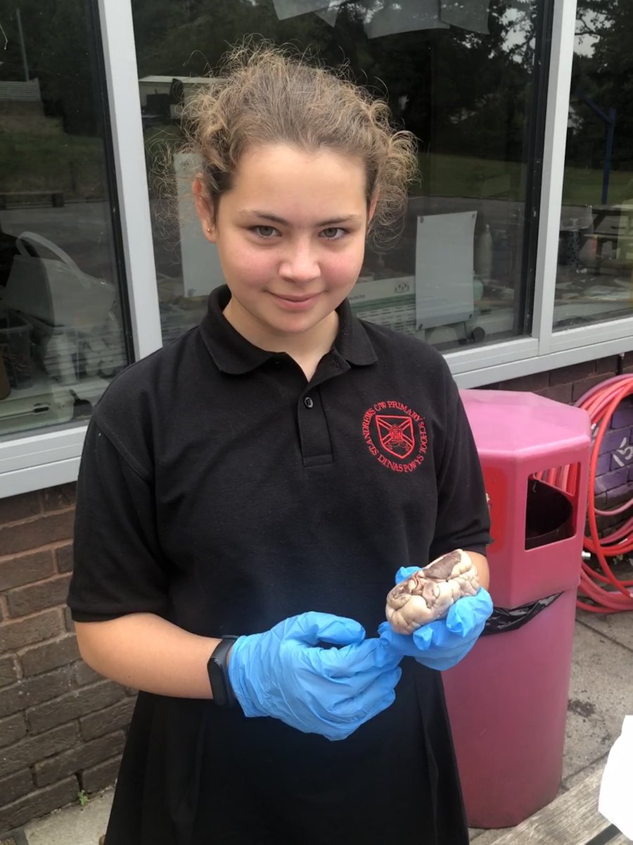standrewsmajor's tweet photo. Our final three were back in to dissect the lamb hearts today β€οΈ #SAMsY6 #SAMsTopic #SAMsScience https://t.co/LqroX4LjdO