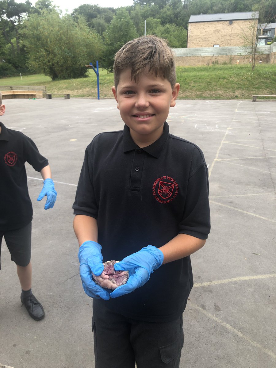 standrewsmajor's tweet photo. Our final three were back in to dissect the lamb hearts today β€οΈ #SAMsY6 #SAMsTopic #SAMsScience https://t.co/LqroX4LjdO