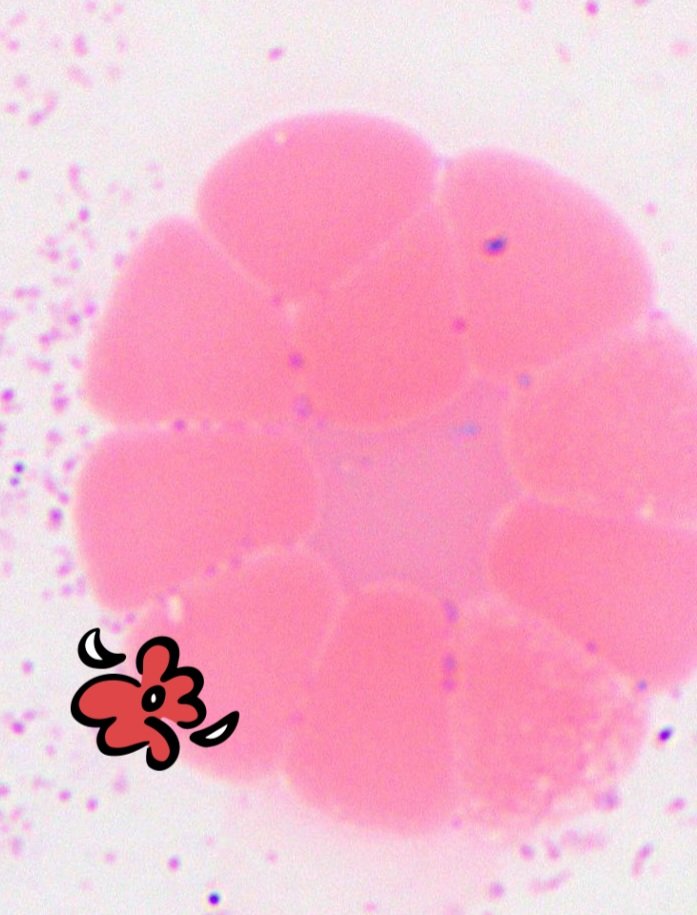 padmapathology1's tweet photo. My thought process..
Not so perfect flowers,
yet perfect in their own sense ๐ธ๐ฎ
#pathreidolia #PathTwitter https://t.co/rE65zK0VTT