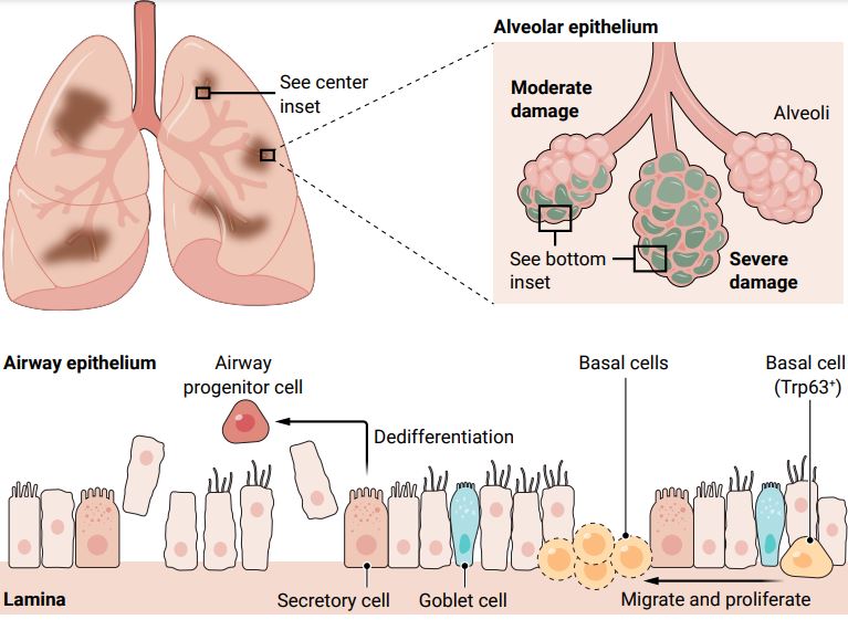 A new Review contextualizes what happens the lungs and body following damage caused by respiratory viral infections such as #influenza and #SARSCoV2. <a href="/Jie_Immunology/">Jie Sun</a> <a href="/hnarasim23/">Harish Narasimhan</a> 

fcld.ly/6elvtks