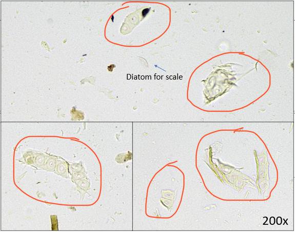 Twitter, please help us out: what do you think these "mystery bits" are? Red circles below. Animal pieces? Plant matter? They were seen in gut contents of a stonefly living in a glacier-fed stream. Thanks!

cc <a href="/AquaJorg/">Karen Jorgenson</a> @eco_scollins <a href="/streambug/">deb finn</a> <a href="/BenthosNews/">Freshwater Science</a> <a href="/aslo_org/">ASLO</a>