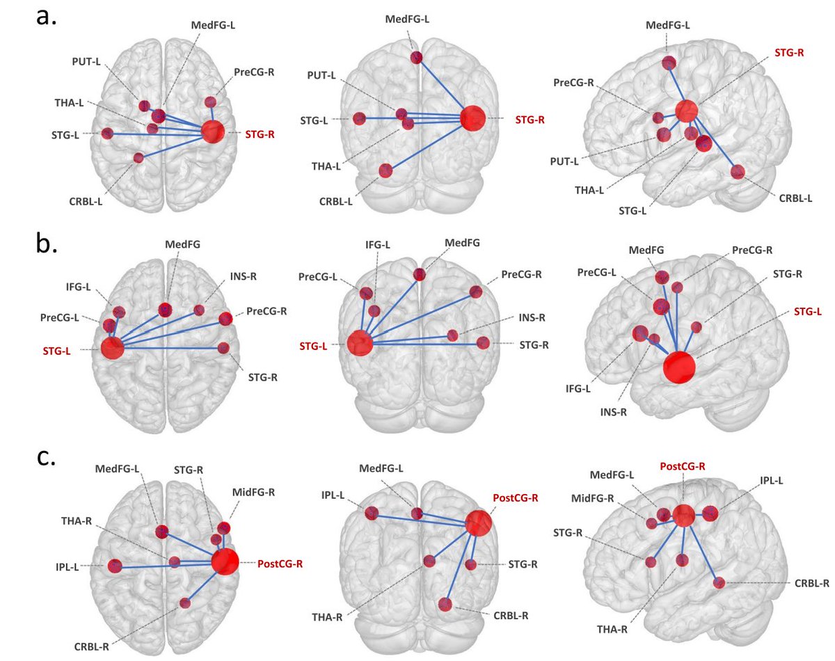 AntoCris95's tweet photo. HUGE SMILE ON MY FACE
Wonder how your #brain changes with #music training?
Decades of research and >1000 screened studies summarized in a coherent #cortico-subcortical sensorimotor #network.
Check our meta-analysis on:
https://t.co/aCSp0UQM4j https://t.co/Id2491VFfY
