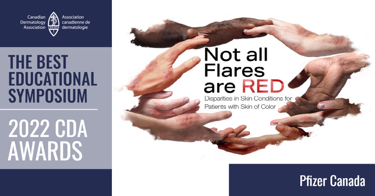 Canadian Dermatology (@cdndermatology) on Twitter photo The year’s “Best Educational Symposium” held at the CDA Annual Conference went to <a href="/PfizerCA/">Pfizer Canada</a> for their “Not all Flares are Red; Disparities in Skin Conditions for Patients with Skin of Color” symposium. This information packed presentation was a job well done 👏! The year’s “Best Educational Symposium” held at the CDA Annual Conference went to <a href="/PfizerCA/">Pfizer Canada</a> for their “Not all Flares are Red; Disparities in Skin Conditions for Patients with Skin of Color” symposium. This information packed presentation was a job well done 👏!