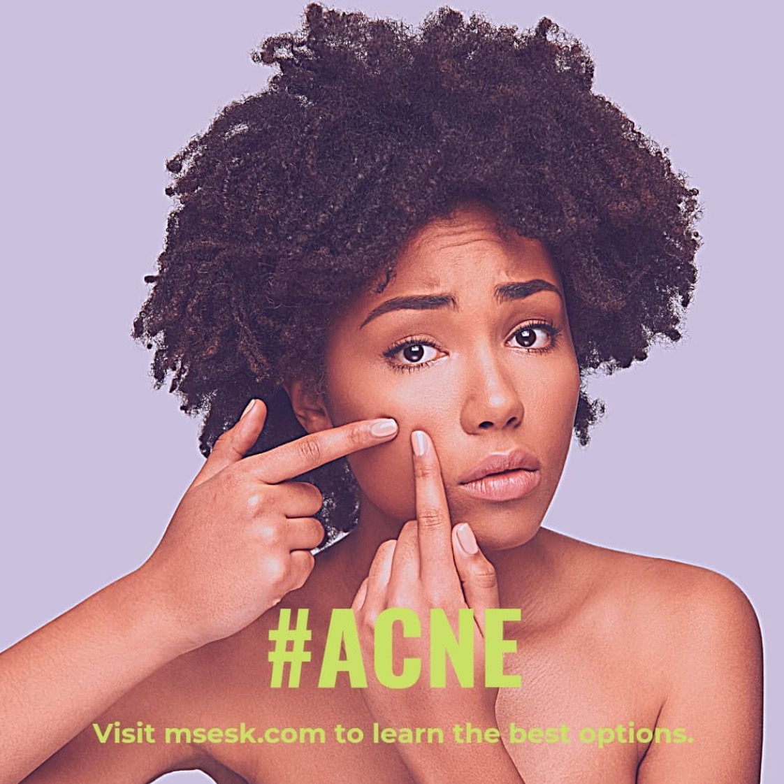 AaronSecrestMD's tweet photo. #acne can #flare at any time - from #stress or #diet or a combination. Learn the #best #otc #acne #treatments (https://t.co/SCzKieKPnO and https://t.co/X4Y48tmRz6). #excellent #deals today for #amazon #primeday @AcneFree #adapalene
#msesk #dermatology #dermatologia #skincare https://t.co/3OWpGxmCyH
